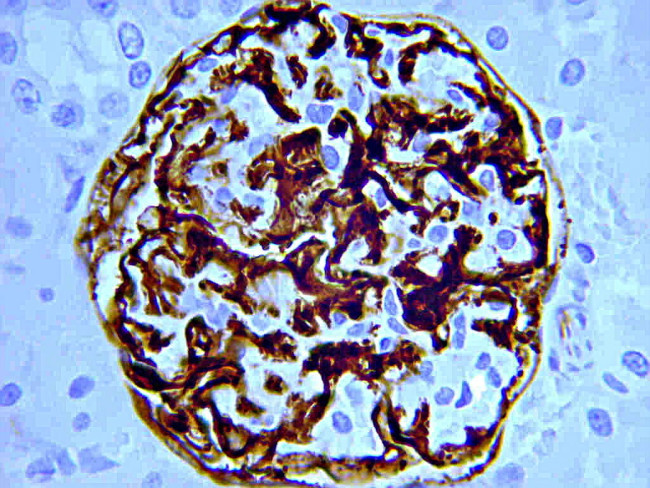 Nestin Antibody in Immunohistochemistry (Paraffin) (IHC (P))