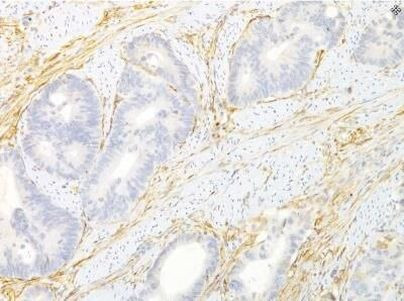 TEM8 Antibody in Immunohistochemistry (Paraffin) (IHC (P))