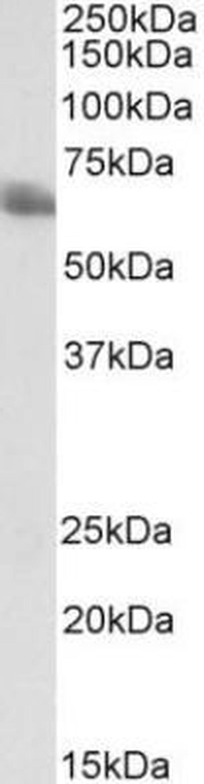 TEM8 Antibody in Western Blot (WB)