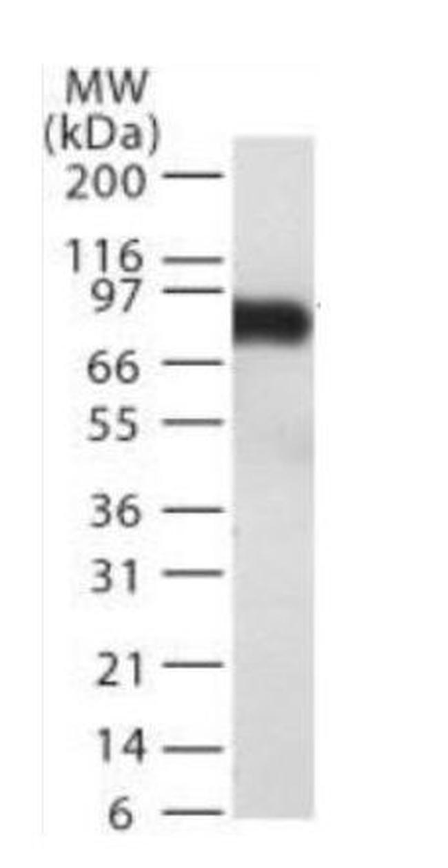 TEM8 Antibody in Western Blot (WB)