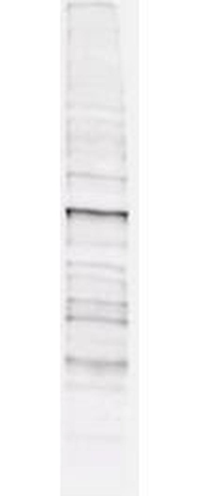 Phosphothreonine Antibody in Western Blot (WB)