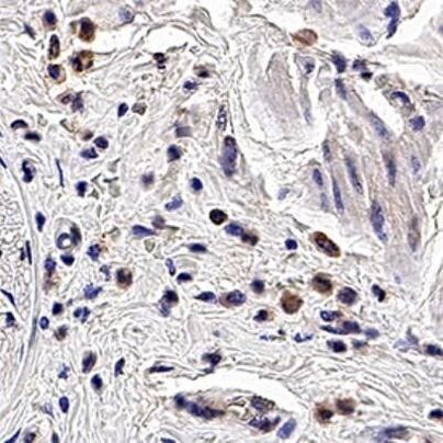 PGRP-S Antibody in Immunohistochemistry (Paraffin) (IHC (P))