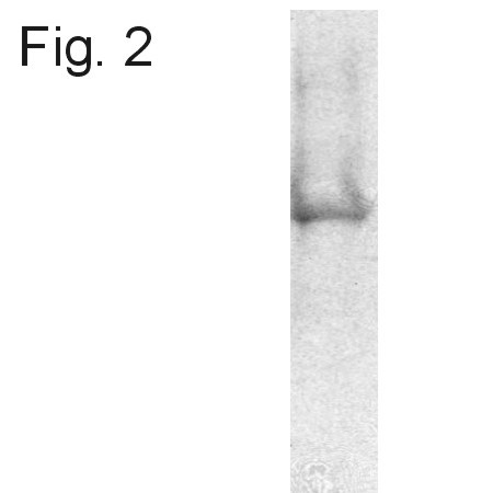 ATP Synthase beta Antibody in Western Blot (WB)