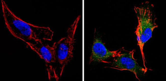 Recoverin Antibody in Immunocytochemistry (ICC/IF)