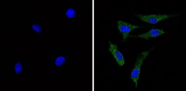 Recoverin Antibody in Immunocytochemistry (ICC/IF)