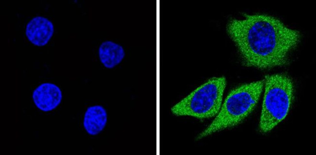 Recoverin Antibody in Immunocytochemistry (ICC/IF)