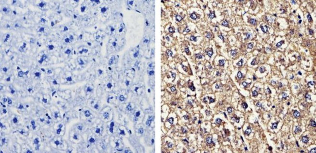 Recoverin Antibody in Immunohistochemistry (Paraffin) (IHC (P))