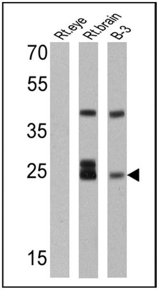 Recoverin Antibody in Western Blot (WB)