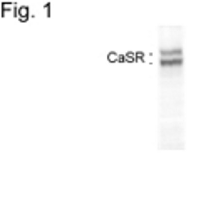 Calcium Sensing Receptor Antibody in Western Blot (WB)