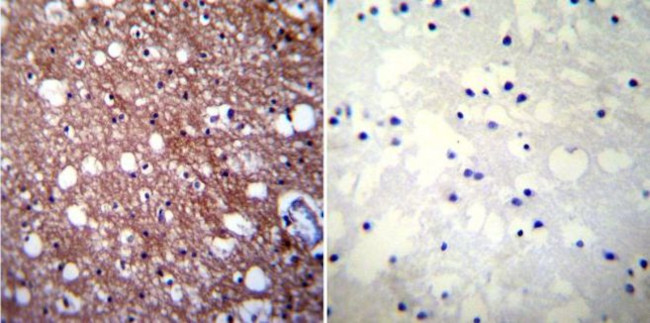 Calcium Sensing Receptor Antibody in Immunohistochemistry (Paraffin) (IHC (P))