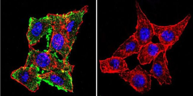 CFTR Antibody in Immunocytochemistry (ICC/IF)