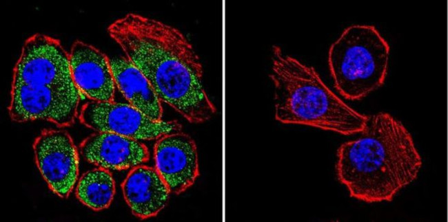 CFTR Antibody in Immunocytochemistry (ICC/IF)