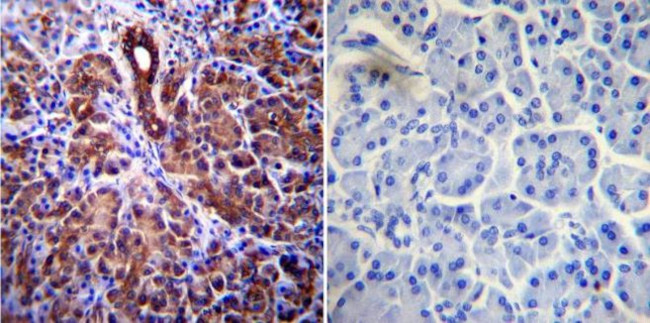 CFTR Antibody in Immunohistochemistry (Paraffin) (IHC (P))