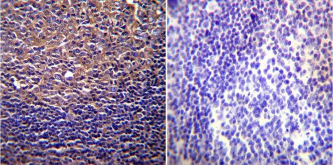 CFTR Antibody in Immunohistochemistry (Paraffin) (IHC (P))