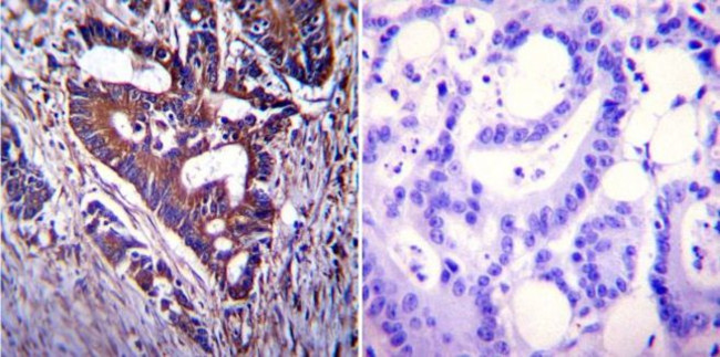 CFTR Antibody in Immunohistochemistry (Paraffin) (IHC (P))