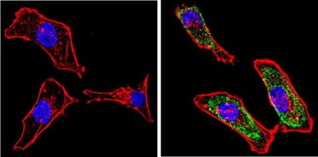 Galectin 3 Antibody in Immunocytochemistry (ICC/IF)