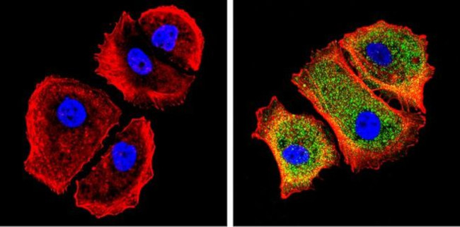 Galectin 3 Antibody in Immunocytochemistry (ICC/IF)