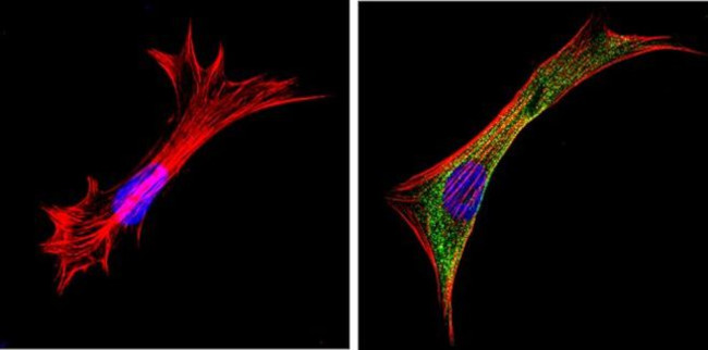 Galectin 3 Antibody in Immunocytochemistry (ICC/IF)