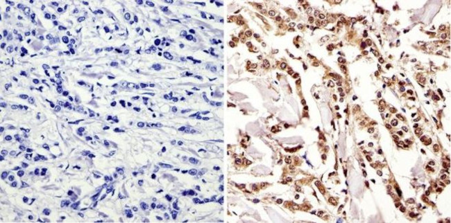 c-Myc Antibody in Immunohistochemistry (Paraffin) (IHC (P))