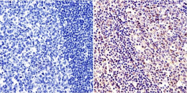 c-Myc Antibody in Immunohistochemistry (Paraffin) (IHC (P))