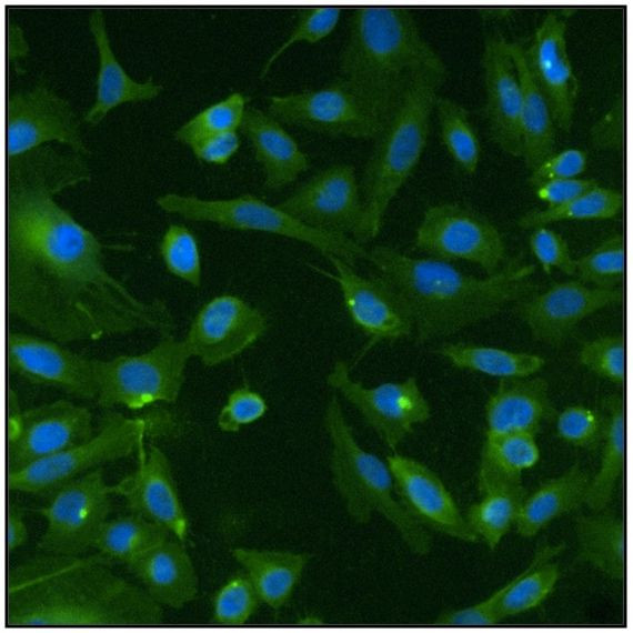 Pan Ras Antibody in Immunocytochemistry (ICC/IF)