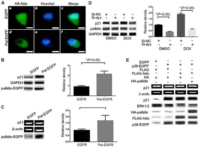 Pan Ras Antibody in Western Blot (WB)