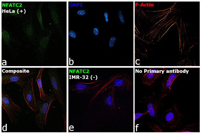 NFATC2 Antibody