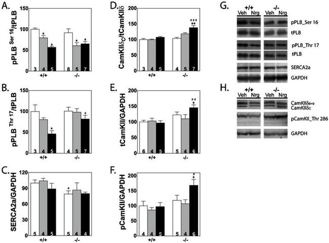 SERCA2 ATPase Antibody in Western Blot (WB)