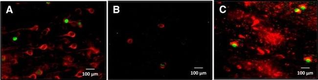 CaMKII alpha Antibody in Immunohistochemistry (IHC)