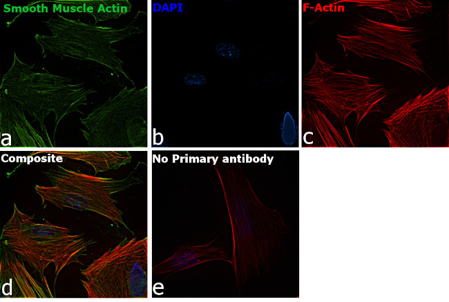 Alpha-Smooth Muscle Actin Antibody in Immunocytochemistry (ICC/IF)