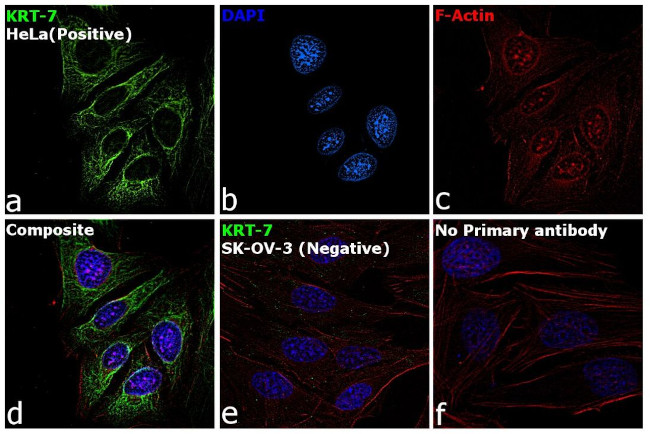 Cytokeratin 7 Antibody in Immunocytochemistry (ICC/IF)