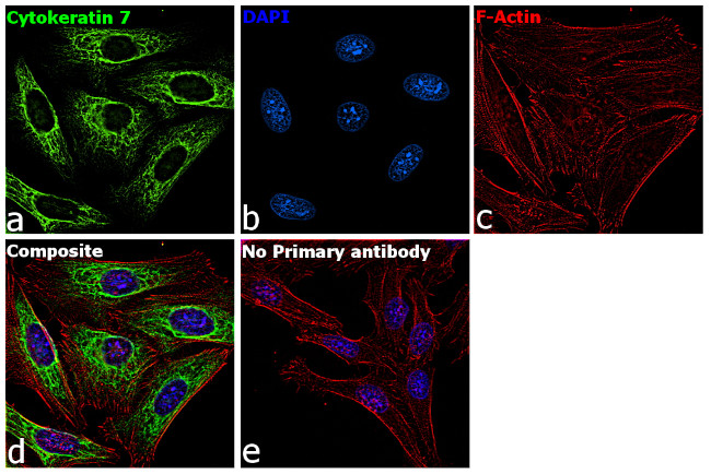 Cytokeratin 7 Antibody in Immunocytochemistry (ICC/IF)