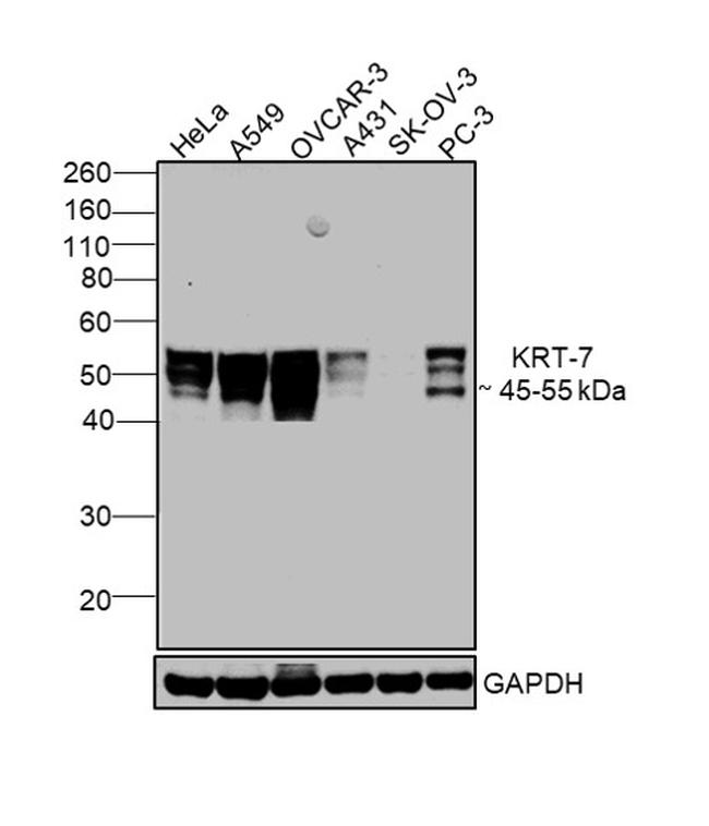 Cytokeratin 7 Antibody in Western Blot (WB)