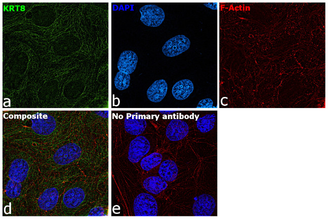 Cytokeratin 8 Antibody in Immunocytochemistry (ICC/IF)