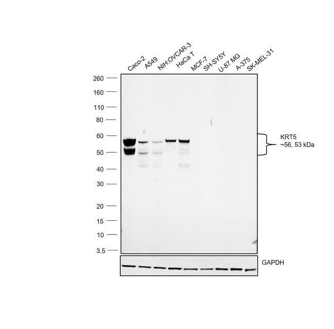 Cytokeratin 8 Antibody in Western Blot (WB)