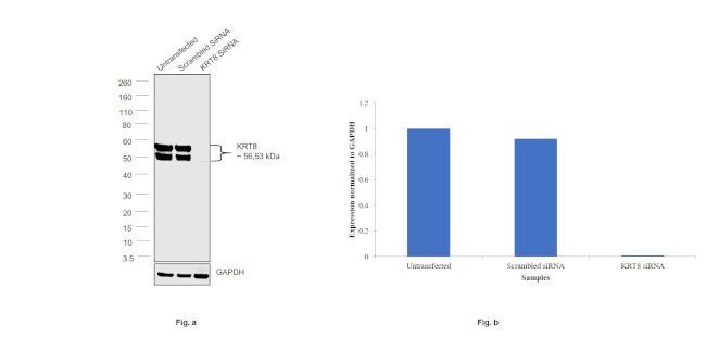 Cytokeratin 8 Antibody