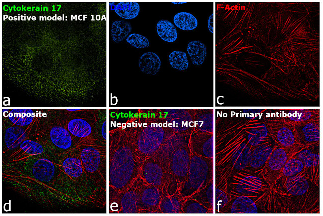 Cytokeratin 17 Antibody