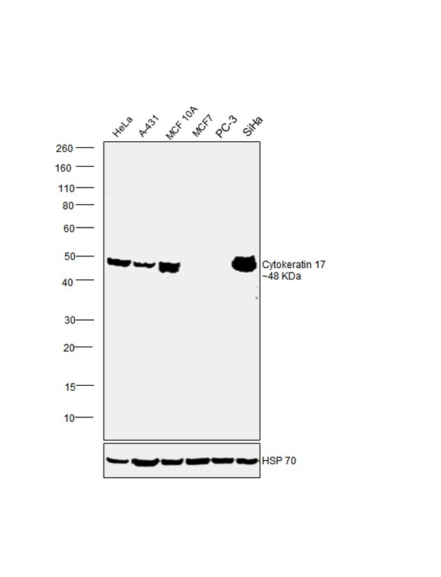 Cytokeratin 17 Antibody