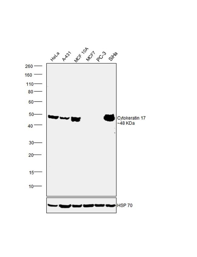 Cytokeratin 17 Antibody in Western Blot (WB)