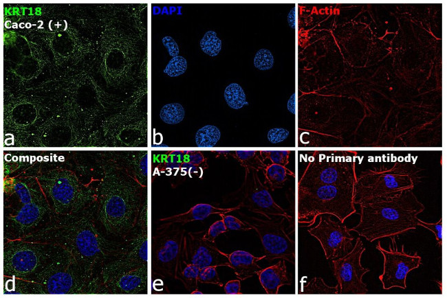 Cytokeratin 18 Antibody in Immunocytochemistry (ICC/IF)