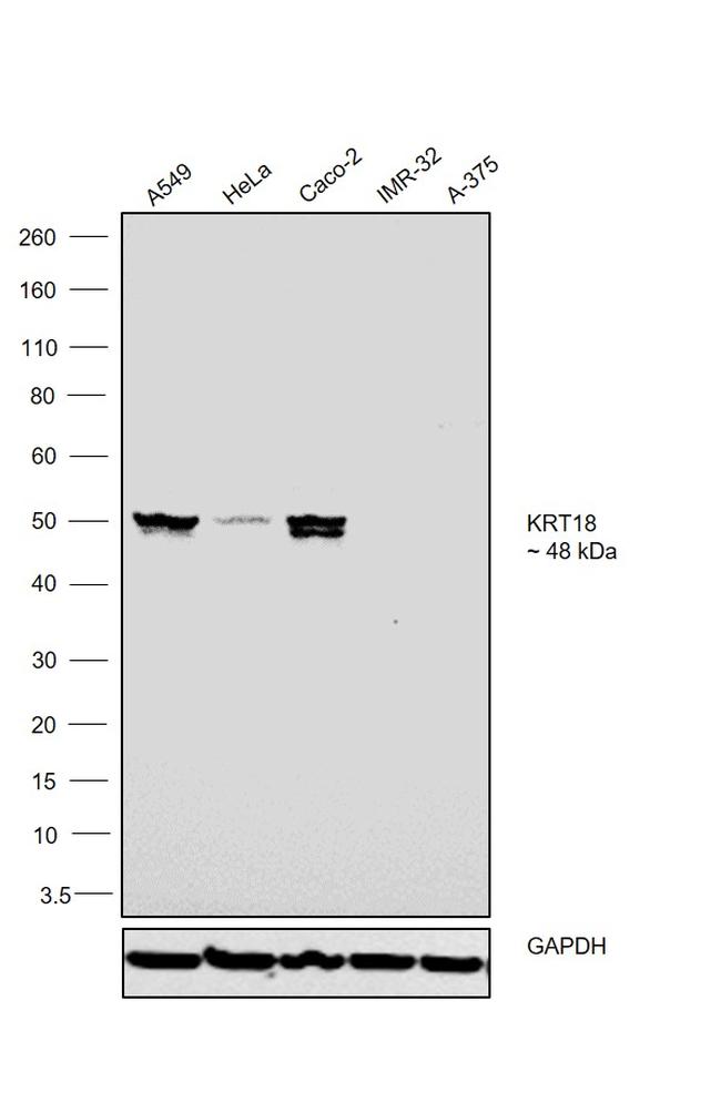 Cytokeratin 18 Antibody in Western Blot (WB)