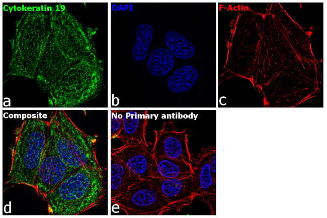 Cytokeratin 19 Antibody in Immunocytochemistry (ICC/IF)