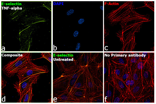 E-selectin Antibody in Immunocytochemistry (ICC/IF)