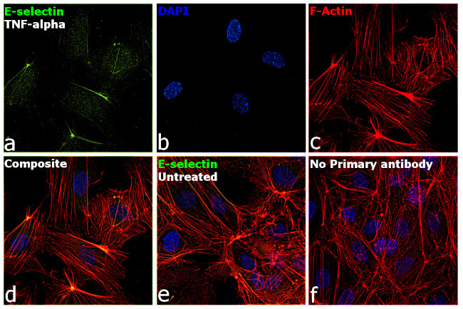 E-selectin Antibody in Immunocytochemistry (ICC/IF)