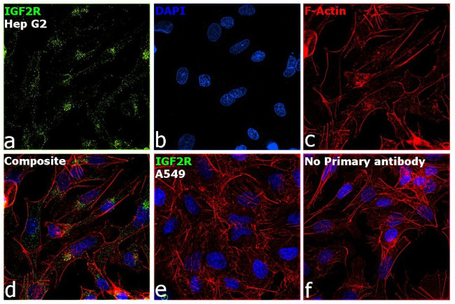 IGF2R Antibody in Immunocytochemistry (ICC/IF)