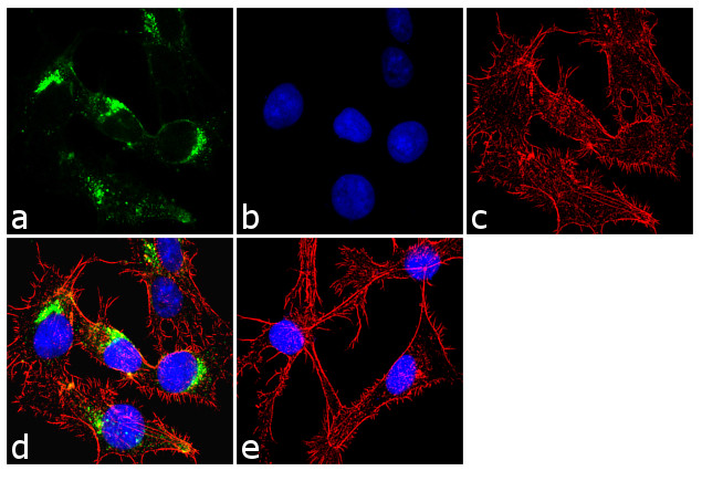 IGF2R Antibody in Immunocytochemistry (ICC/IF)