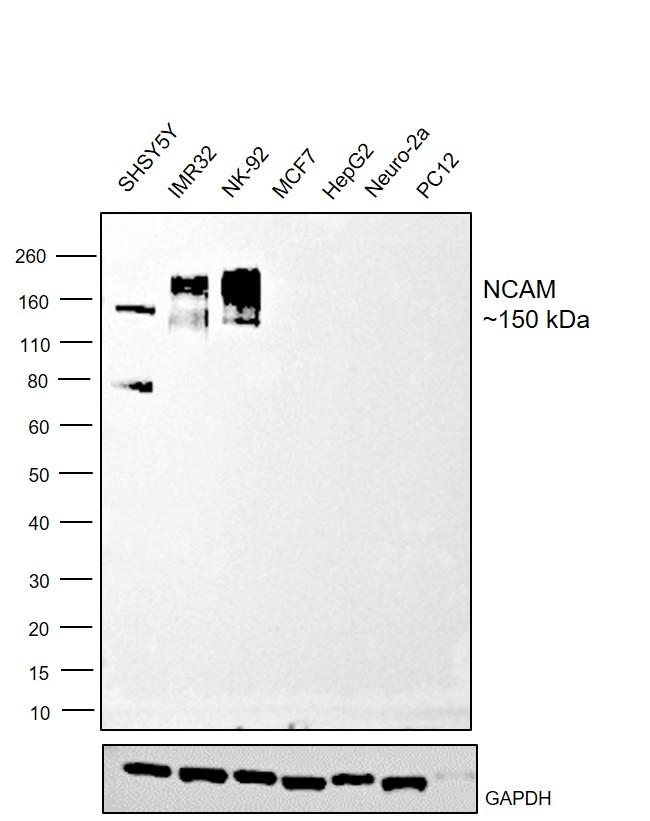 CD56 Antibody in Western Blot (WB)