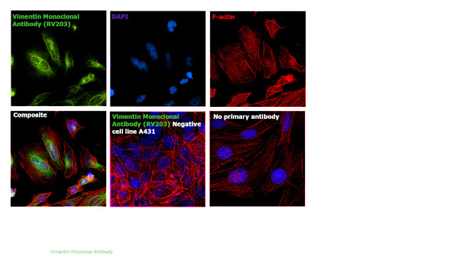 Vimentin Antibody in Immunocytochemistry (ICC/IF)