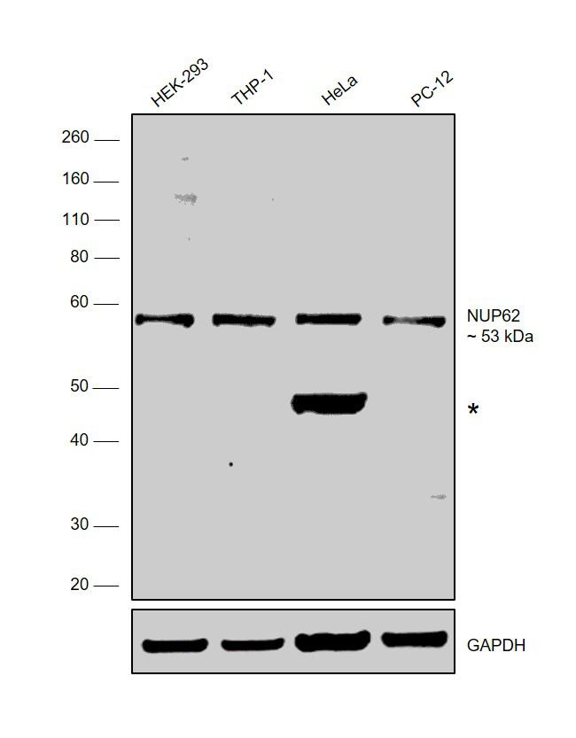 NUP62 Antibody in Western Blot (WB)