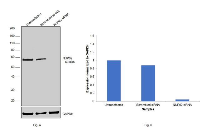 NUP62 Antibody in Western Blot (WB)